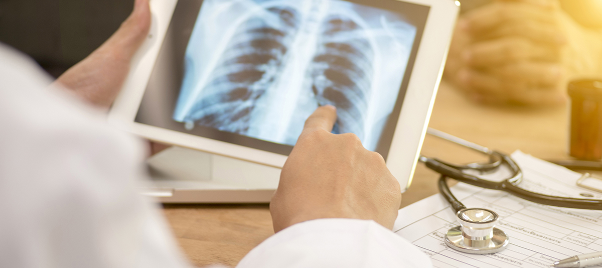 A closeup photograph of a medical professional examining an x-ray of a patient's chest on a tablet.